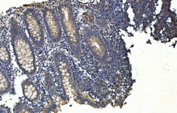 IHC staining of FFPE human appendicitis tissue with APPL1 antibody. HIER: boil tissue sections in pH