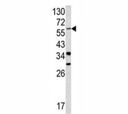 Western blot analysis of YAP antibody and NCI-H460 lysate. Predicted molecular weight ~54 kDa but ro