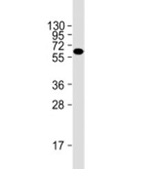 Western blot testing of HeLa cell lysate with Natriuretic Peptide Receptor C antibody at 1:2000. Pre
