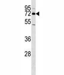 NURR1 Antibody