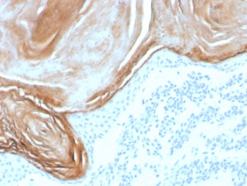 Kallikrein 7 Antibody / KLK7
