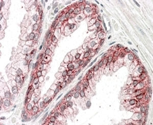 IHC staining of FFPE human prostate with alpha Catenin antibody at 3.8ug/ml. HIER: steamed with pH6 