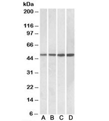 Western blot testing of Daudi [A], human tonsil [B], human spleen [C] and mouse spleen [D] lysates w