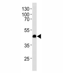 CXCR7 Antibody