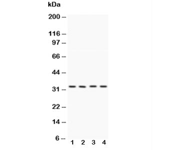 Western blot testing of Caspase-7 antibody and Lane 1: HeLa; 2: MCF-7; 3: rat liver; 4: rat kidney l