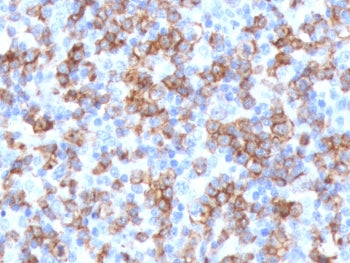 IHC testing of FFPE human tonsil with recombinant CD8 antibody (clone CDLA8a-2R). Required HIER: boi