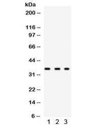 Western blot testing of human 1) HeLa, 2) 293 and 3 MCF7 lysate with SPARC antibody. Observed molecu