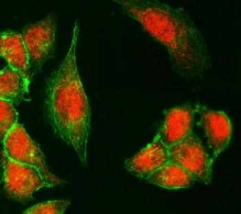 Immunofluorescent staining of FFPE human SiHa cells with KDM6A antibody (Dylight 594-conjugated seco