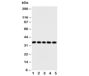FosB Antibody
