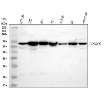 Western blot analysis of LINGO2 using anti-LINGO2 antibody. Lane 1: human SH-SY5Y whole cell lysates