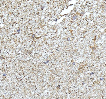 Western blot testing of NDRG2 antibody and Lane 1: SMMC-7721; 2: PANC lysate. Expected/observed mole