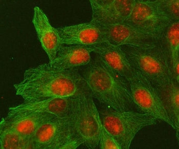 Immunofluorescent staining of FFPE human U-2 OS cells with MACROH2A2 antibody (red) and Beta Tubulin