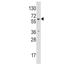 Western blot analysis of CYP19A1 / Aromatase antibody and Jurkat lysate. Predicted molecular weight 