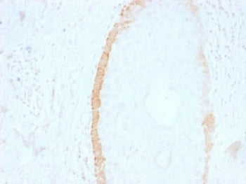 KRT15 Antibody / Cytokeratin 15