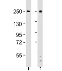 Western blot testing of human 1) Ramos and 2) THP-1 cell lysate with DOCK8 antibody at 1:2000. Predi
