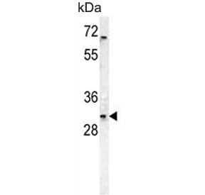 Western blot testing of human HEK293 cell lysate with DcR3 antibody. Predicted molecular weight ~33 