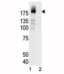 Phospho-EGFR Antibody (pY998)