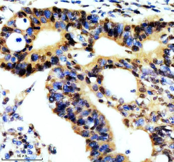 Immunohistochemical staining of REST using anti-REST antibody. REST was detected in a paraffin-embed