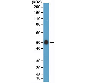 Western blot testing of human placenta lysate with recombinant CD14 antibody at 1:100 dilution. Pred
