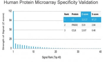 Analysis of HuProt(TM) microarray containing more than 19,000 full-length human proteins using Inter