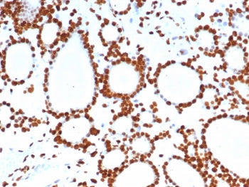 IHC staining of FFPE human thyroid tissue with PET-1 antibody (clone FEV/7311). HIER: boil tissue se