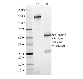 SDS-PAGE analysis of purified, BSA-free SMAD4 antibody (clone SMAD4/2524) as confirmation of integri