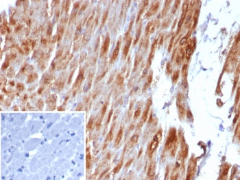 IHC staining of FFPE human heart muscle tissue with Desmin antibody (clone DES/8610R). Inset: PBS us