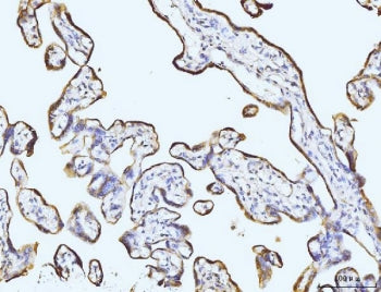 BZW2 Antibody