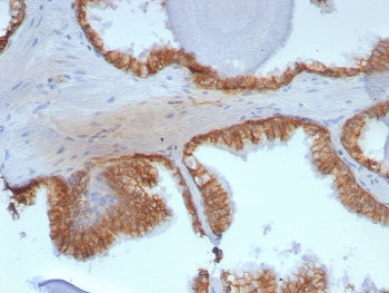 IHC staining of FFPE human prostate tissue with CTNNB1 antibody (clone rCTNNB1/8043). HIER: boil tis