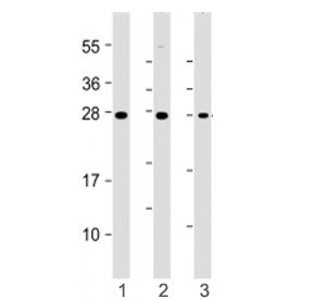 Western blot testing of HAVCR2 antibody at 1:4000: Lane 1) human HepG2, 2) Daudi and 3) kidney lysat