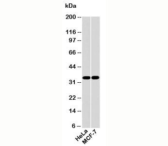 Western blot testing of human samples with EMAP II antibody at 2ug/ml. Predicted molecular weight: ~