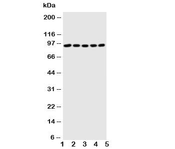 Western blot testing of STAT1 antibody and Lane 1: MM451; 2: HeLa; 3: HT1080; 4: SW620; 5: Jurkat ce