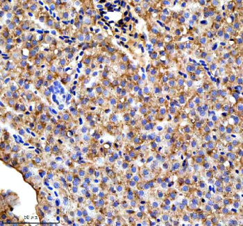 Immunohistochemical analysis of Ttc7b protein using Zebrafish Ttc7b antibody, HRP secondary and DAB 