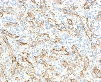 IHC staining of FFPE human spleen with recombinant TNFSF15 antibody (clone TLRM1-2R). Required HIER: