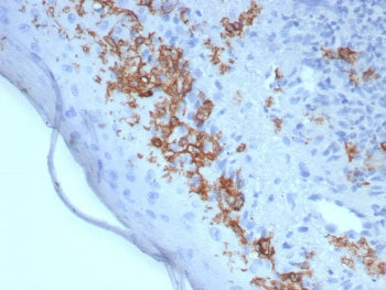 IHC staining of FFPE human skin tissue with CD1a antibody (clone rC1A/8110). HIER: boil tissue secti