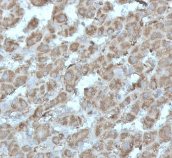 Recombinant DNA topoisomerase I Antibody / TOP1MT