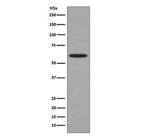 Western blot testing of human HeLa cell lysate with HSPD1 antibody. Predicted molecular weight ~60 k