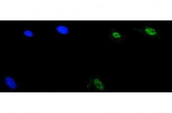 ZIC2 Antibody