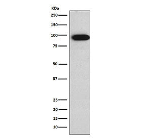 Western blot testing of human Caco-2 cell lysate with Villin antibody. Predicted molecular weight ~9