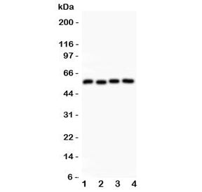 Western blot testing of Cyclin B1 antibody and Lane 1: HeLa; 2: 293T; 3: MCF-7; 4: COLO320 lysate. P