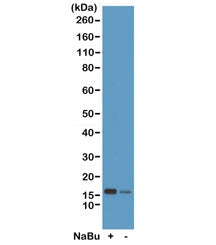 Western blot test of acid extracts from HeLa cells treated (+) or untreated (-) with sodium butyrate
