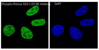 Immunofluorescent staining of human HeLa cells treated and untreated with H2O2 using phospho-Histone