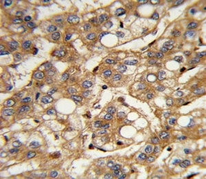 Interferon beta Antibody