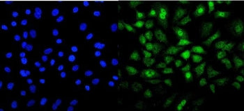 Immunofluorescent staining of FFPE human A549 cells with MESP2 antibody (green) and DAPI nuclear sta