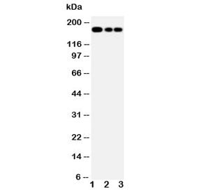 Western blot testing of MRP1 antibody and Lane 1: Jurkat; 2: CEM; 3: A549 lysate. Predicted molecula