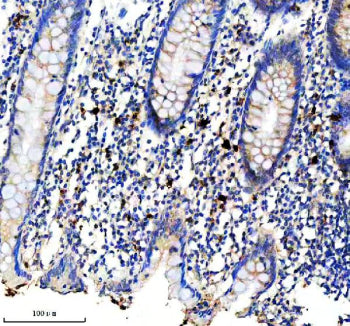 Immunohistochemical staining of CD163b/CD163L1 using anti-CD163L1 antibody. CD163L1 was detected in 