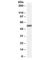 Western blot testing of human skin lysate with ZMPSTE24 antibody at 0.5ug/ml. Predicted molecular we