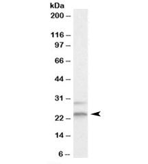 Western blot testing of HEK293 lysate with MAD2L1 antibody at 2ug/ml. The expected ~24kDa band and t