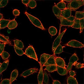 Immunofluorescent staining of PFA-fixed human HeLa cells using Ubiquitin-protein ligase E3A antibody