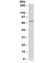 Western blot testing of rat heart lysate with NGFR antibody at 1ug/ml. Predicted molecular weight ~4